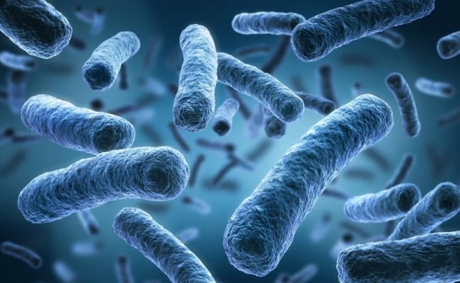 Legionella
